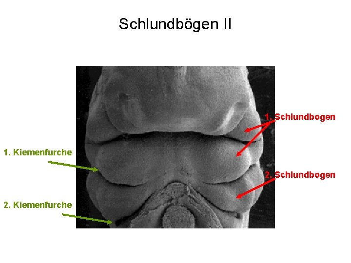 Schlundbögen II 1. Schlundbogen 1. Kiemenfurche 2. Schlundbogen 2. Kiemenfurche 