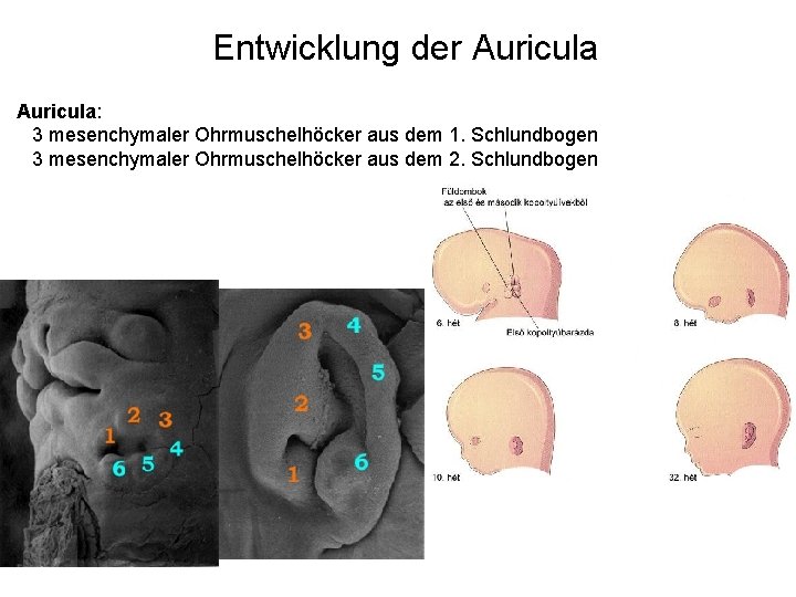 Entwicklung der Auricula: 3 mesenchymaler Ohrmuschelhöcker aus dem 1. Schlundbogen 3 mesenchymaler Ohrmuschelhöcker aus