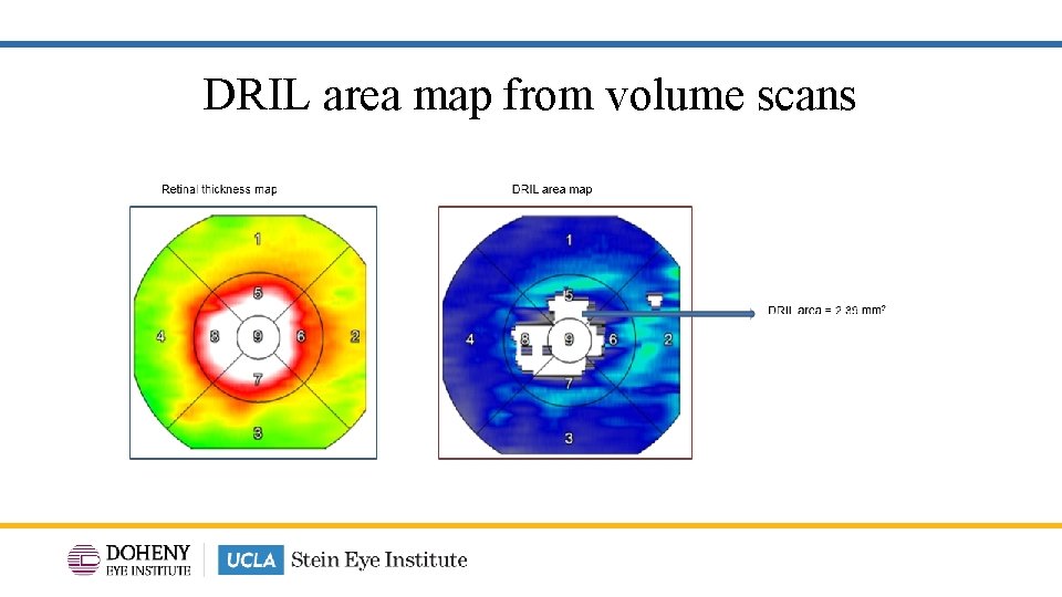 DRIL area map from volume scans 20 