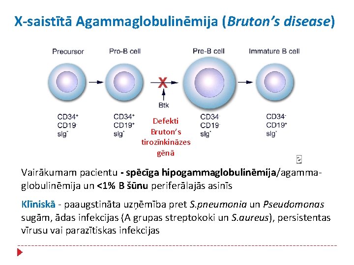 X-saistītā Agammaglobulinēmija (Bruton’s disease) Defekti Bruton’s tirozīnkināzes gēnā Vairākumam pacientu - spēcīga hipogammaglobulinēmija/agammaglobulinēmija un