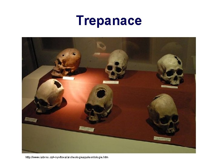 Trepanace http: //www. iabrno. cz/~nyvltova/archeologieapaleontologie. htm 