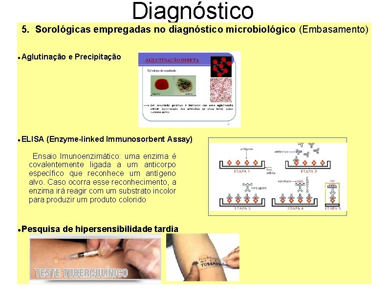 Diagnóstico 5. Sorológicas empregadas no diagnóstico microbiológico (Embasamento) Aglutinação e Precipitação ELISA (Enzyme-linked Immunosorbent