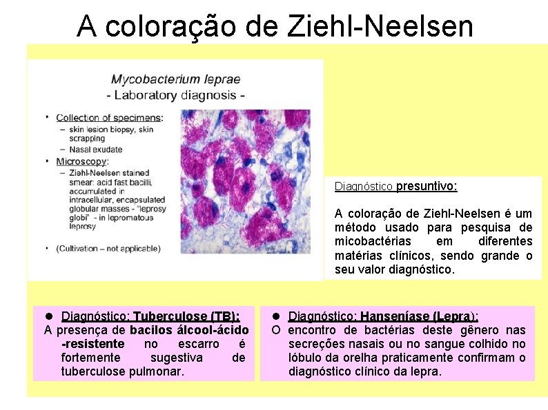 A coloração de Ziehl-Neelsen Diagnóstico presuntivo: A coloração de Ziehl-Neelsen é um método usado