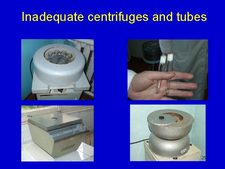 Inadequate centrifuges and tubes 25 Inadequate centrifuges and tubes 25