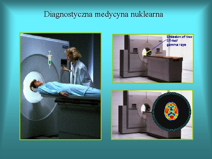 Diagnostyczna medycyna nuklearna 