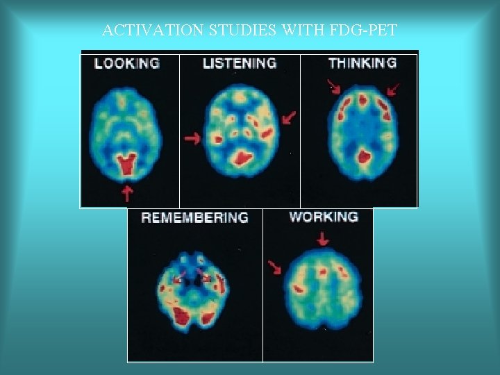 ACTIVATION STUDIES WITH FDG-PET 