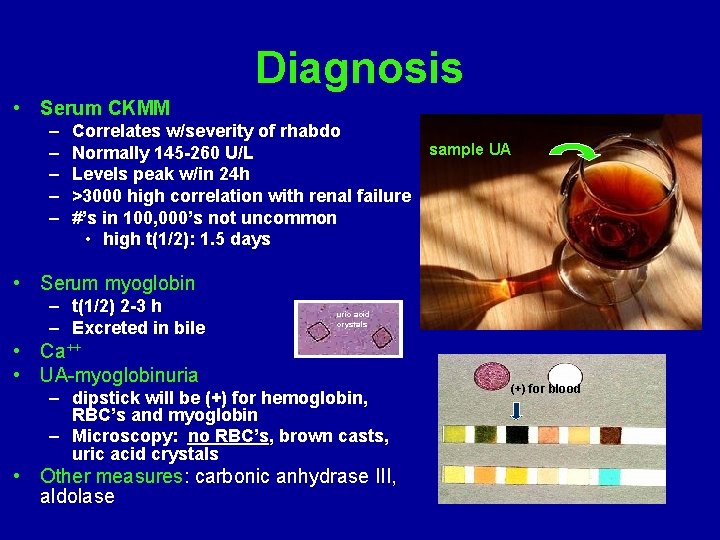 Diagnosis • Serum CKMM – – – Correlates w/severity of rhabdo Normally 145 -260