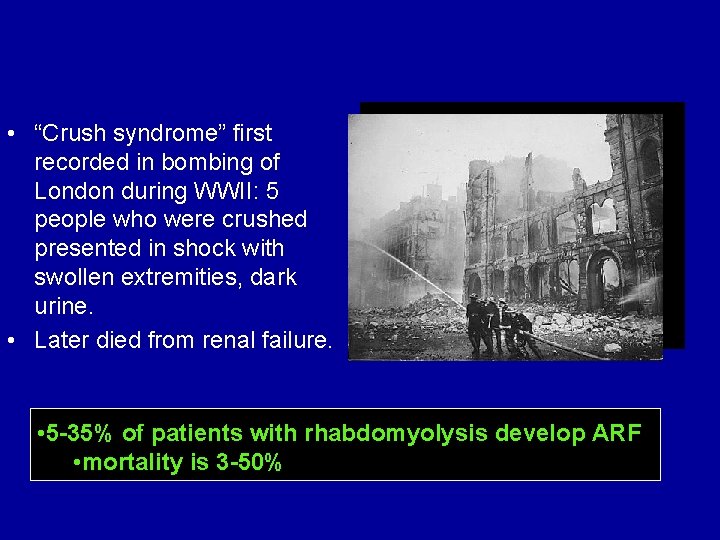  • “Crush syndrome” first recorded in bombing of London during WWII: 5 people
