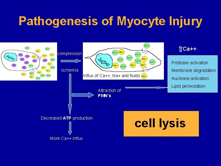 Pathogenesis of Myocyte Injury Ca++ compression Protease activation ischemia Membrane degradation Influx of Ca++,