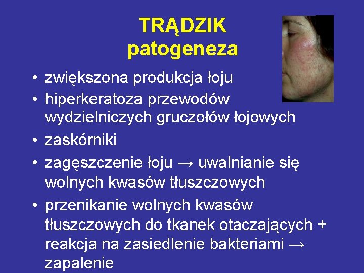 TRĄDZIK patogeneza • zwiększona produkcja łoju • hiperkeratoza przewodów wydzielniczych gruczołów łojowych • zaskórniki