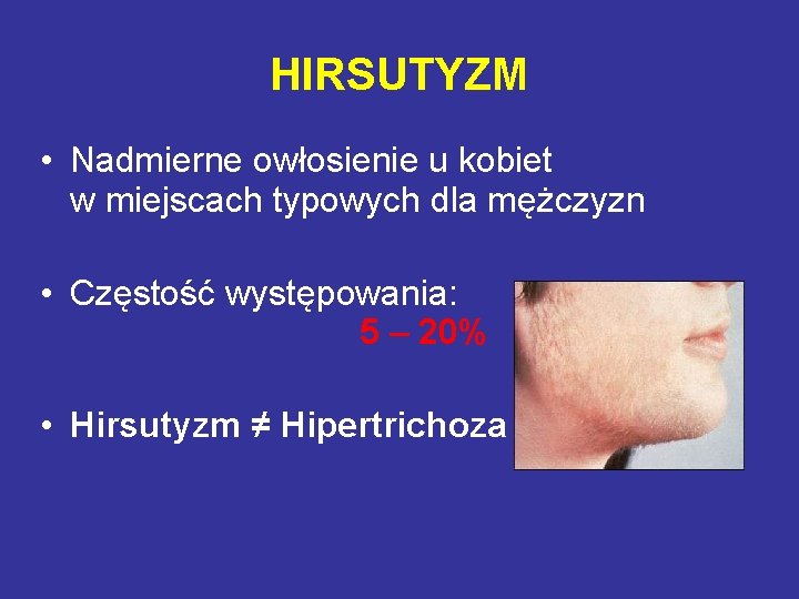 HIRSUTYZM • Nadmierne owłosienie u kobiet w miejscach typowych dla mężczyzn • Częstość występowania: