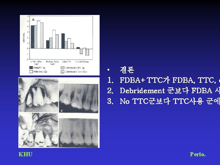  • 1. 2. 3. KHU 결론 FDBA+TTC가 FDBA, TTC, d Debridement 군보다 FDBA