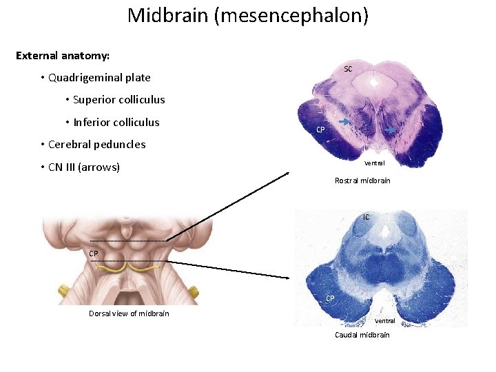 Midbrain (mesencephalon) External anatomy: SC • Quadrigeminal plate • Superior colliculus • Inferior colliculus Midbrain (mesencephalon) External anatomy: SC • Quadrigeminal plate • Superior colliculus • Inferior colliculus