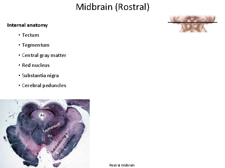 Midbrain (Rostral) Internal anatomy • Tectum • Tegmentum • Central gray matter • Red Midbrain (Rostral) Internal anatomy • Tectum • Tegmentum • Central gray matter • Red