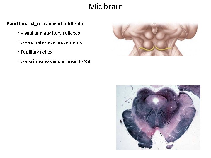 Midbrain Functional significance of midbrain: • Visual and auditory reflexes • Coordinates eye movements