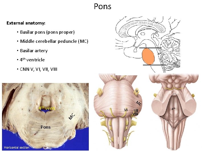 Pons External anatomy: • Basilar pons (pons proper) • Middle cerebellar peduncle (MC) • Pons External anatomy: • Basilar pons (pons proper) • Middle cerebellar peduncle (MC) •