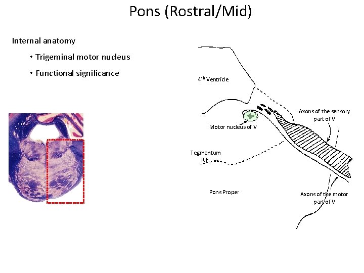 Pons (Rostral/Mid) Internal anatomy • Trigeminal motor nucleus • Functional significance 4 th Ventricle Pons (Rostral/Mid) Internal anatomy • Trigeminal motor nucleus • Functional significance 4 th Ventricle