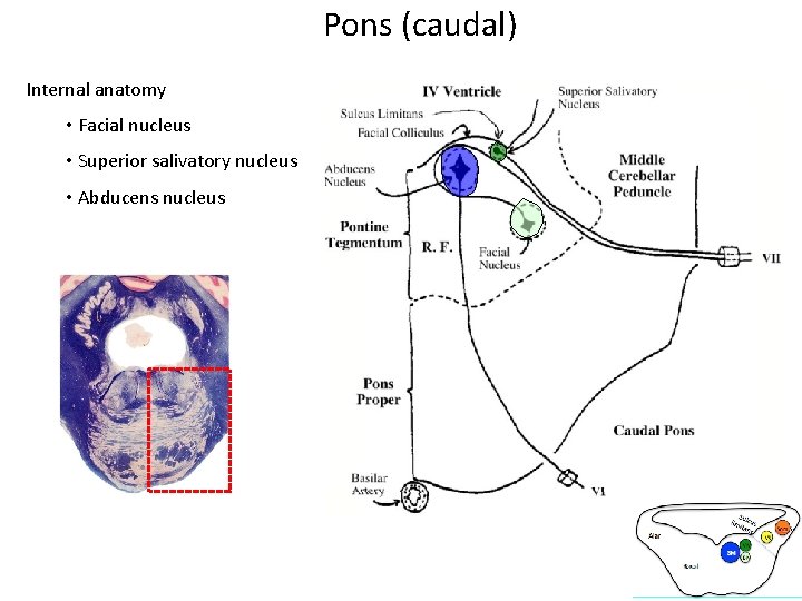 Pons (caudal) Internal anatomy • Facial nucleus • Superior salivatory nucleus • Abducens nucleus Pons (caudal) Internal anatomy • Facial nucleus • Superior salivatory nucleus • Abducens nucleus
