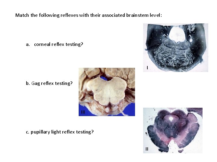 Match the following reflexes with their associated brainstem level: a. corneal reflex testing? I Match the following reflexes with their associated brainstem level: a. corneal reflex testing? I