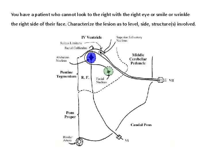 You have a patient who cannot look to the right with the right eye You have a patient who cannot look to the right with the right eye