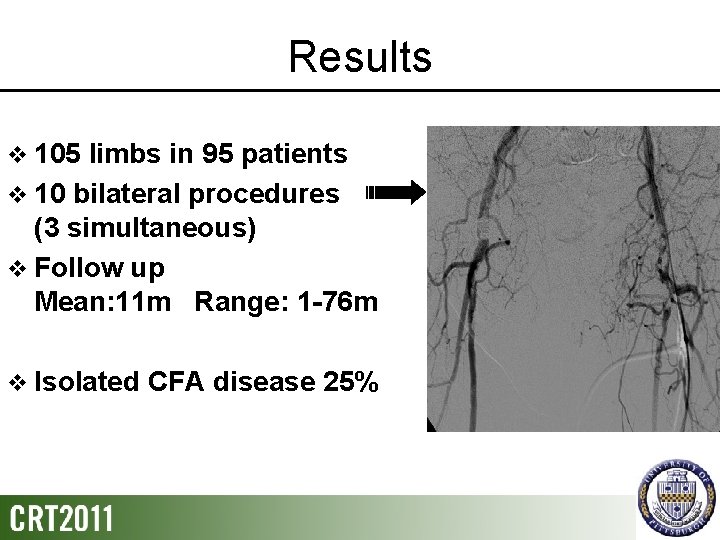 Results v 105 limbs in 95 patients v 10 bilateral procedures (3 simultaneous) v