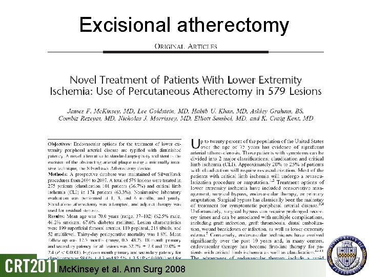 Excisional atherectomy Mc. Kinsey et al. Ann Surg 2008 