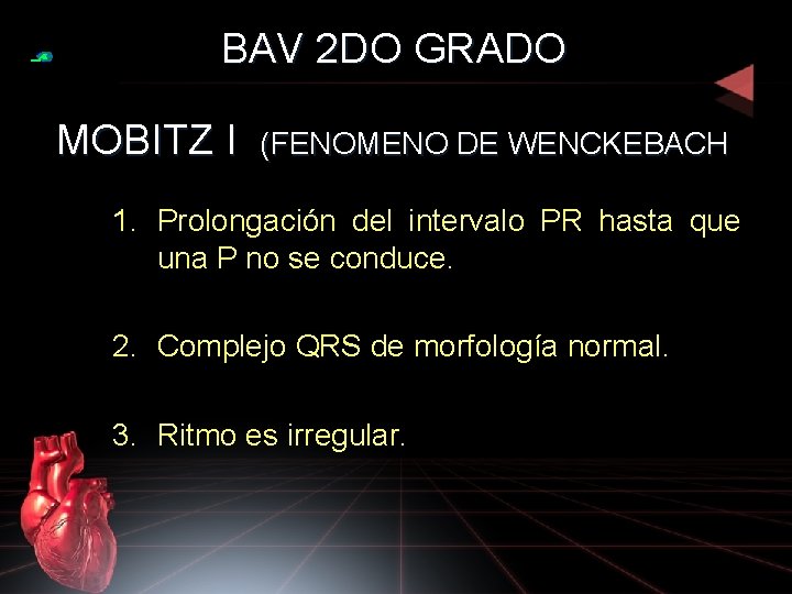 BAV 2 DO GRADO MOBITZ I (FENOMENO DE WENCKEBACH) 1. Prolongación del intervalo PR