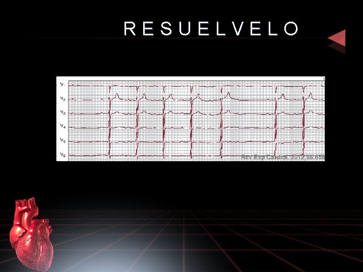 RESUELVELO 