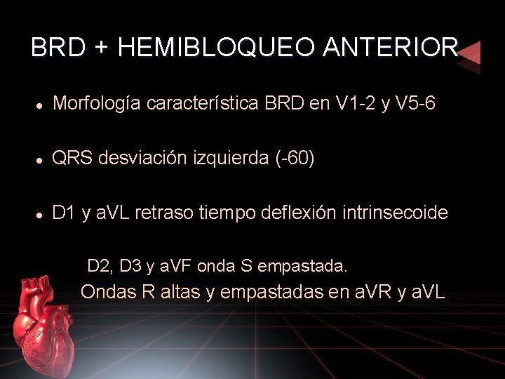 BRD + HEMIBLOQUEO ANTERIOR Morfología característica BRD en V 1 -2 y V 5