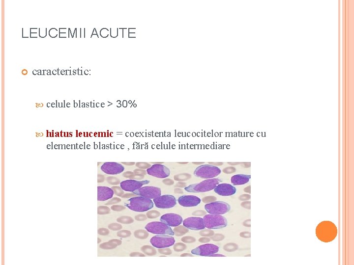 LEUCEMII ACUTE caracteristic: celule blastice ˃ hiatus 30% leucemic = coexistenta leucocitelor mature cu