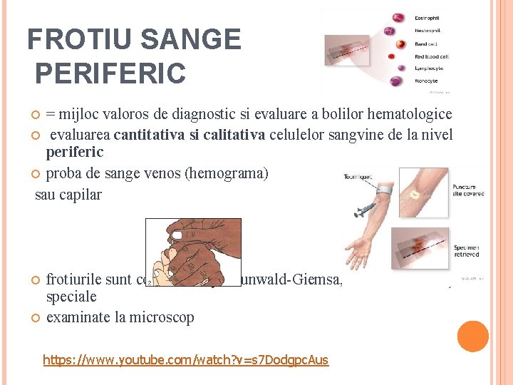 FROTIU SANGE PERIFERIC = mijloc valoros de diagnostic si evaluare a bolilor hematologice evaluarea