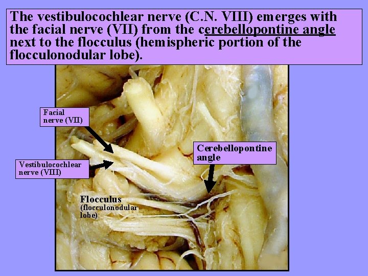 The vestibulocochlear nerve (C. N. VIII) emerges with the facial nerve (VII) from the