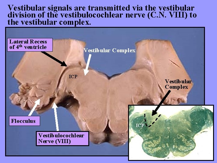 Vestibular signals are transmitted via the vestibular division of the vestibulocochlear nerve (C. N.