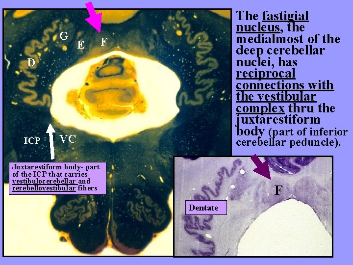 G E The fastigial nucleus, the medialmost of the deep cerebellar nuclei, has reciprocal