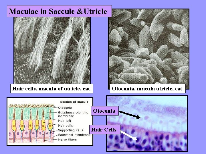 Maculae in Saccule &Utricle Hair cells, macula of utricle, cat Otoconia, macula utricle, cat
