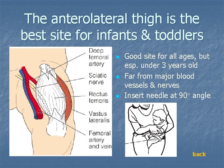 The anterolateral thigh is the best site for infants & toddlers n n n The anterolateral thigh is the best site for infants & toddlers n n n
