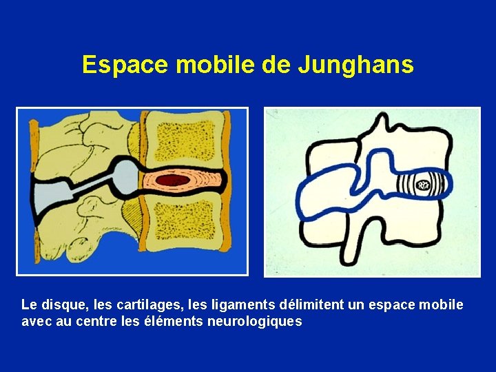 Espace mobile de Junghans Le disque, les cartilages, les ligaments délimitent un espace mobile