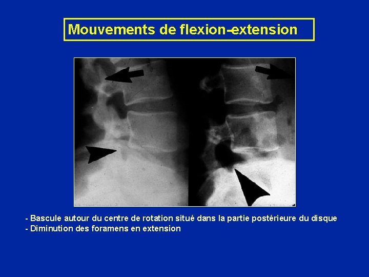 Mouvements de flexion-extension - Bascule autour du centre de rotation situé dans la partie