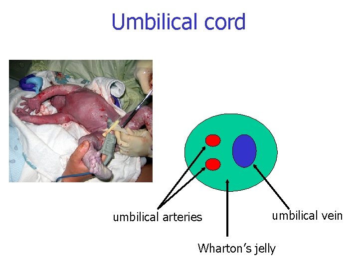 Umbilical cord umbilical arteries umbilical vein Wharton’s jelly 