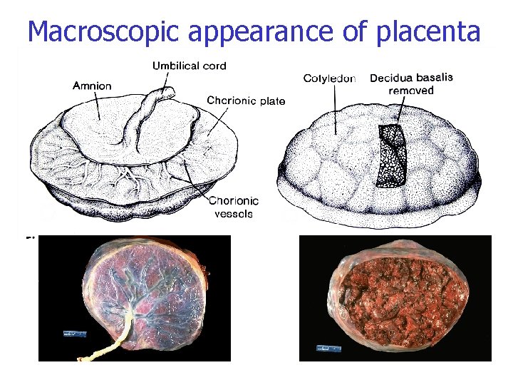 Macroscopic appearance of placenta 