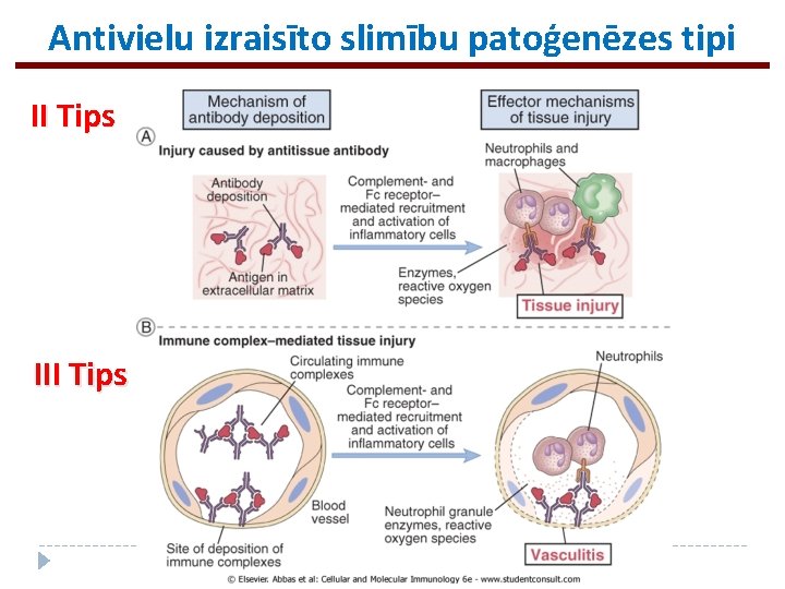 Antivielu izraisīto slimību patoģenēzes tipi II Tips III Tips 