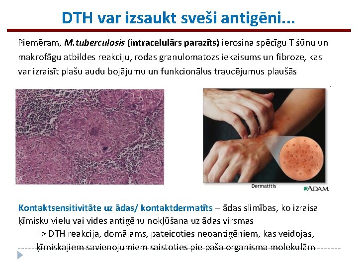 DTH var izsaukt sveši antigēni. . . Piemēram, M. tuberculosis (intracelulārs parazīts) ierosina spēcīgu