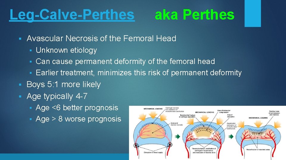 Leg-Calve-Perthes § aka Perthes Avascular Necrosis of the Femoral Head Unknown etiology § Can