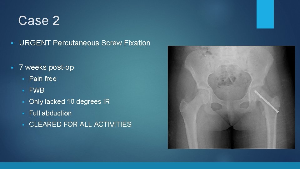 Case 2 § URGENT Percutaneous Screw Fixation § 7 weeks post-op § Pain free