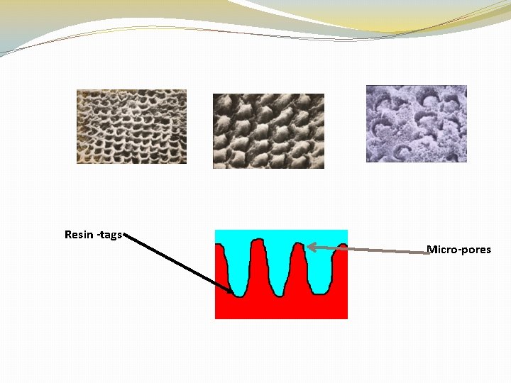 Resin -tags Micro-pores 