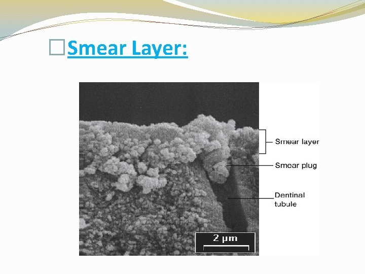 �Smear Layer: 