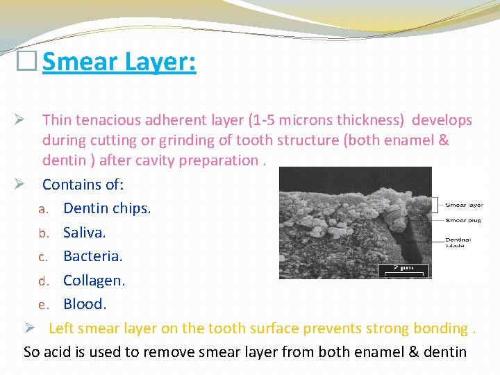 � Smear Layer: Thin tenacious adherent layer (1 -5 microns thickness) develops during cutting