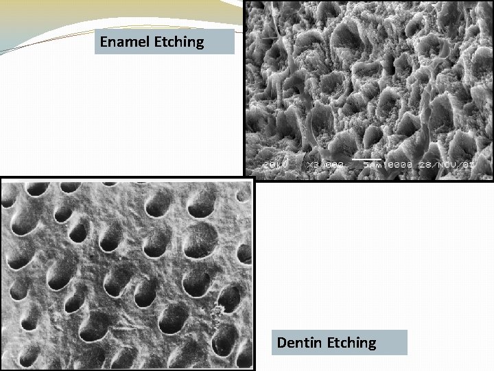 Enamel Etching Dentin Etching 