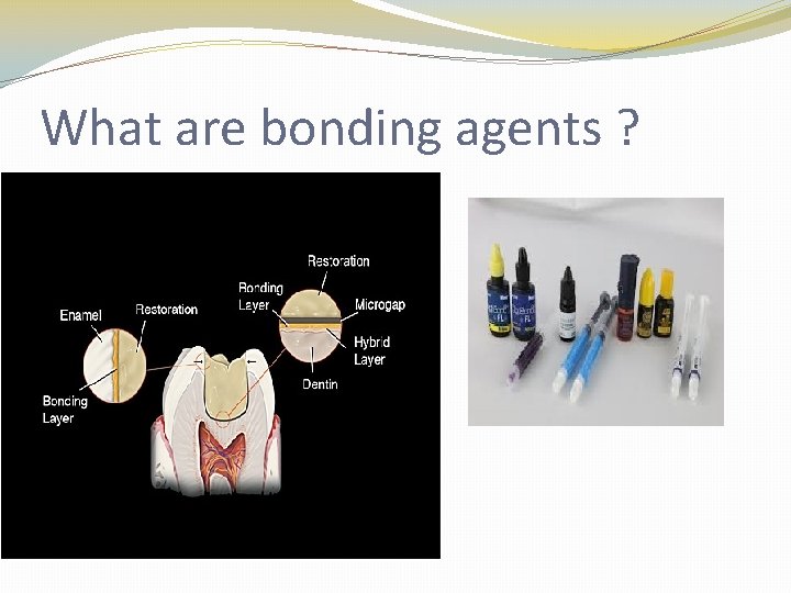 What are bonding agents ? 