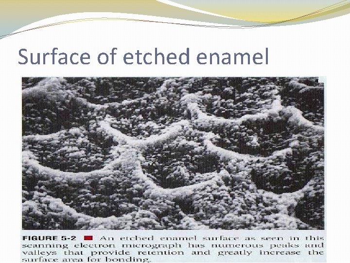 Surface of etched enamel 